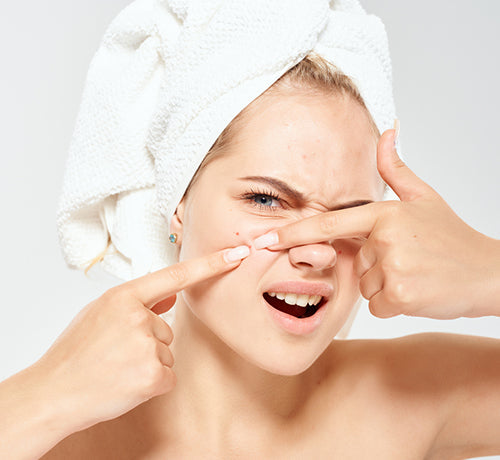 Top Skin Care Products for Acne-Prone Skin