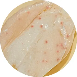 Acne Prone
